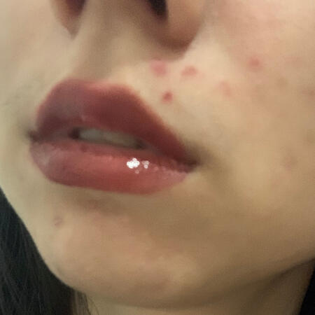 Patchanit Eva Berger